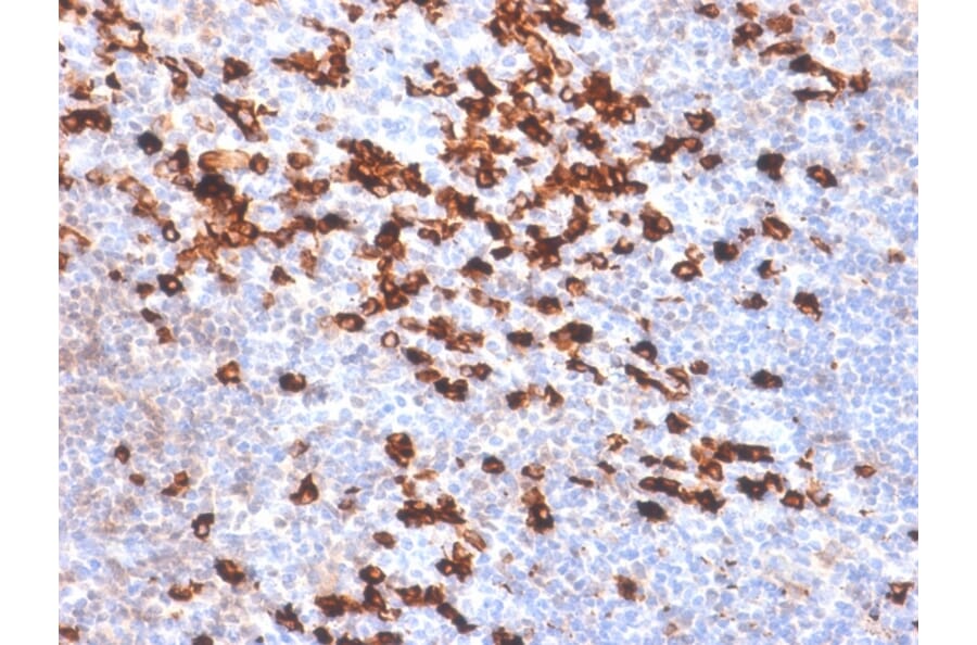 Immunohistochemistry - Anti-Kappa Light Chain Antibody [IGKC/1999R] (A248987) - Antibodies.com