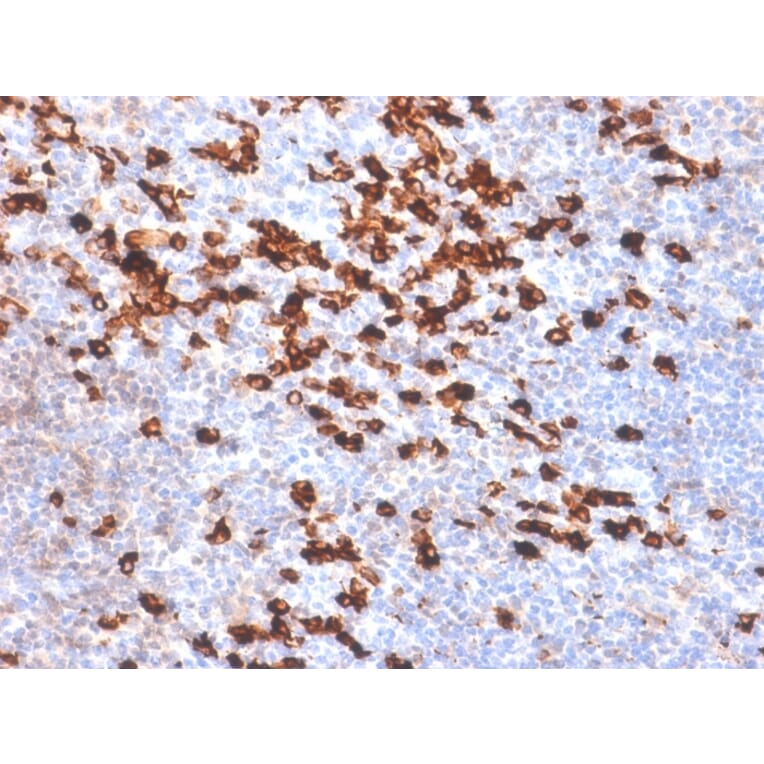 Immunohistochemistry - Anti-Kappa Light Chain Antibody [IGKC/1999R] (A248987) - Antibodies.com