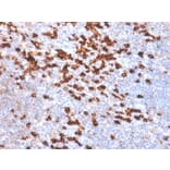 Immunohistochemistry - Anti-Kappa Light Chain Antibody [IGKC/1999R] (A248987) - Antibodies.com