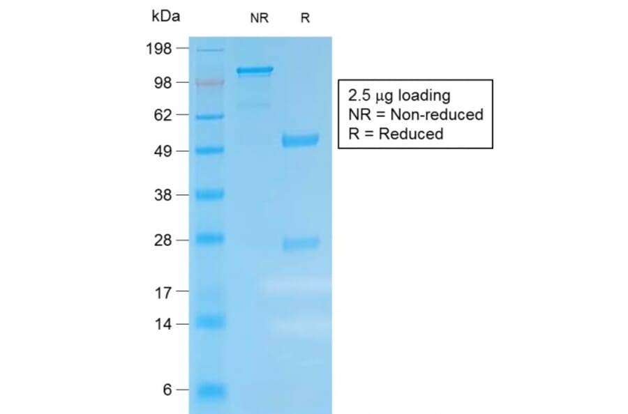 SDS-PAGE - Anti-Kappa Light Chain Antibody [IGKC/1999R] (A248987) - Antibodies.com