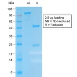 SDS-PAGE - Anti-Kappa Light Chain Antibody [IGKC/1999R] (A248987) - Antibodies.com