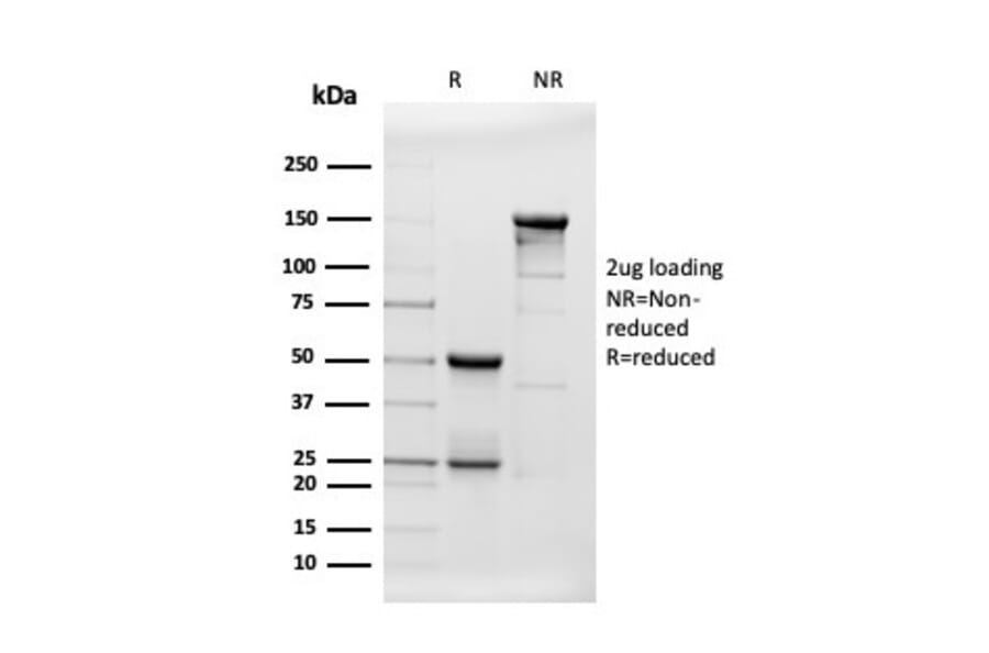 SDS-PAGE - Anti-beta Amyloid Antibody [APP/3343] (A248988) - Antibodies.com