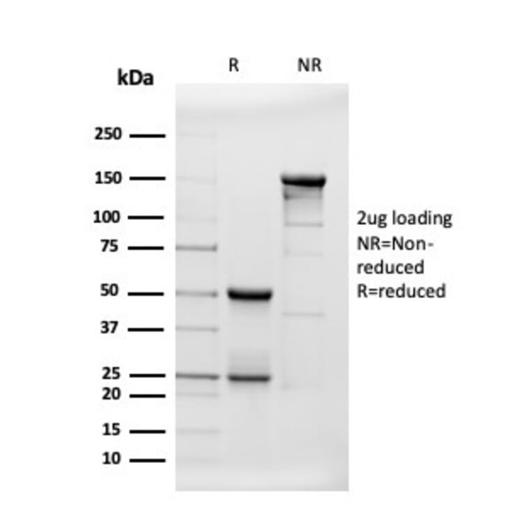 SDS-PAGE - Anti-beta Amyloid Antibody [APP/3343] (A248988) - Antibodies.com