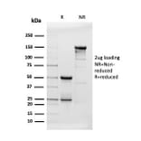 SDS-PAGE - Anti-beta Amyloid Antibody [APP/3343] (A248988) - Antibodies.com