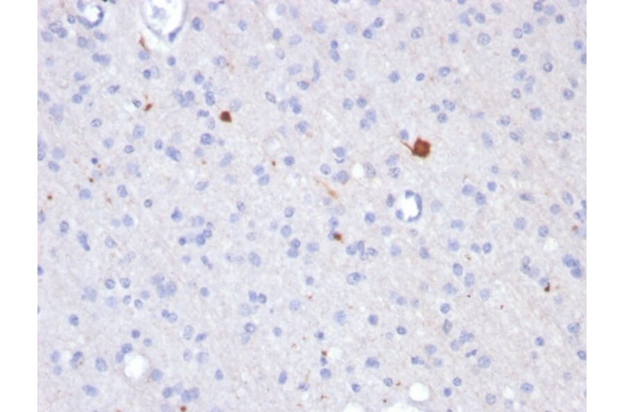 Immunohistochemistry - Anti-beta Amyloid Antibody [APP/3343] (A248988) - Antibodies.com