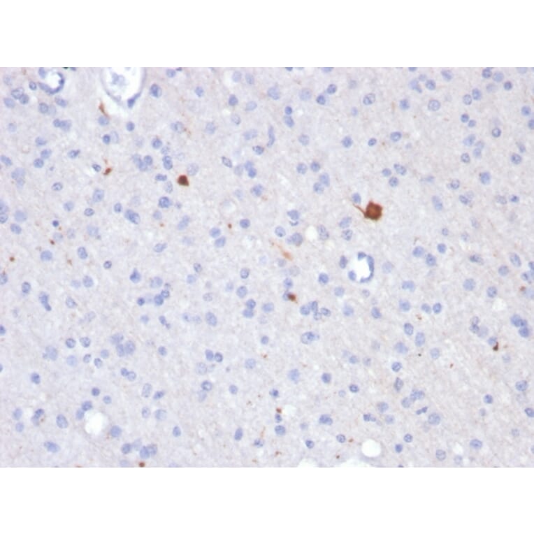 Immunohistochemistry - Anti-beta Amyloid Antibody [APP/3343] (A248988) - Antibodies.com