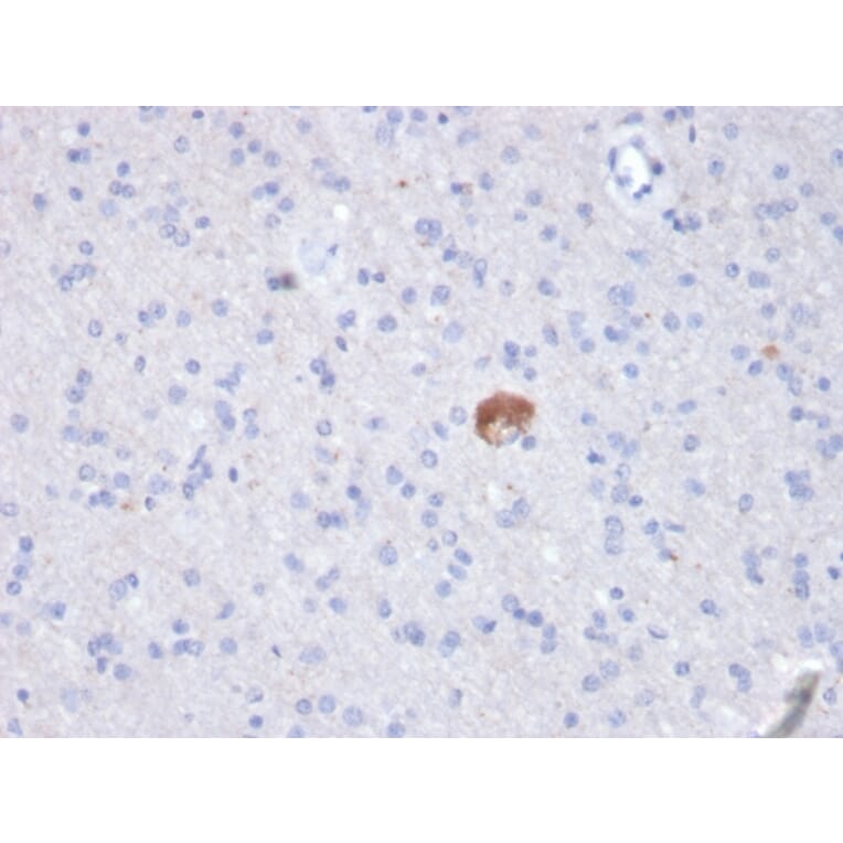 Immunohistochemistry - Anti-beta Amyloid Antibody [APP/3343] (A248988) - Antibodies.com