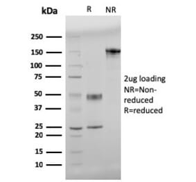 SDS-PAGE - Anti-beta Amyloid Antibody [APP/3345] (A248989) - Antibodies.com