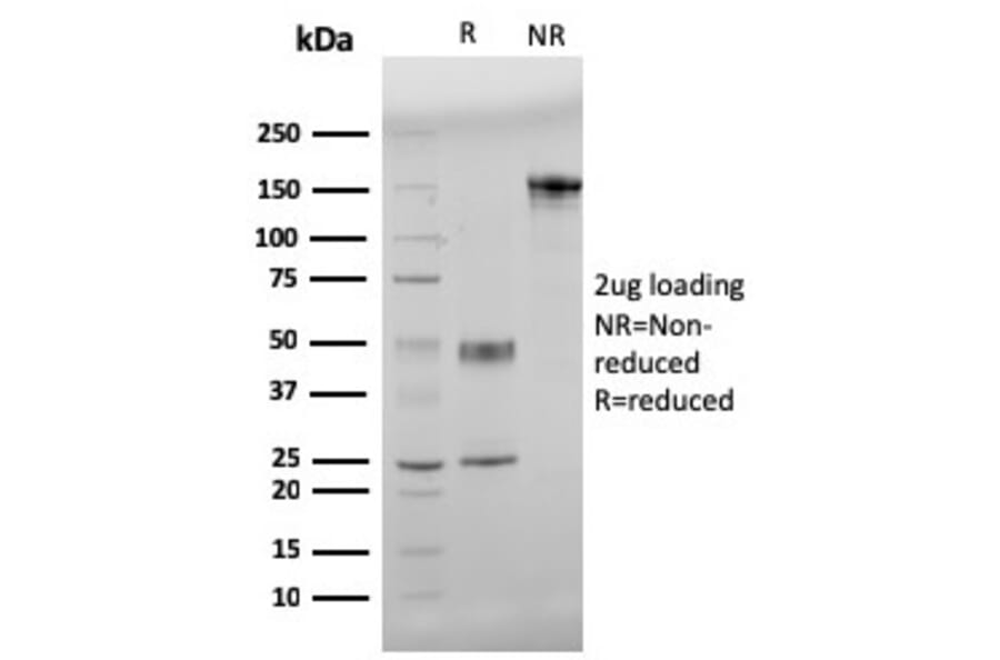 SDS-PAGE - Anti-beta Amyloid Antibody [APP/3345] (A248989) - Antibodies.com
