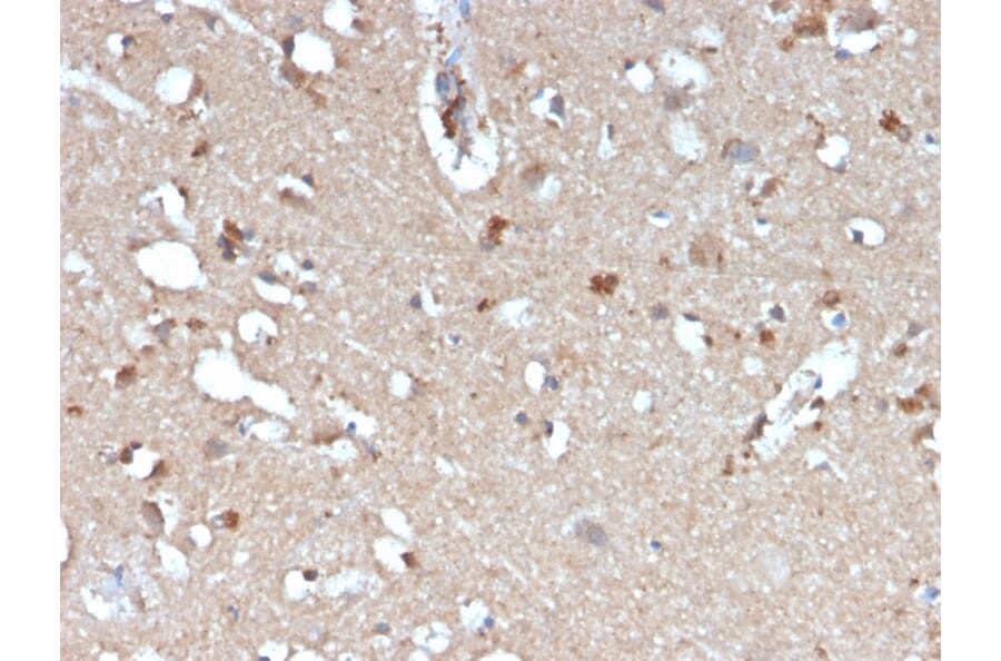 Immunohistochemistry - Anti-beta Amyloid Antibody [APP/3345] (A248989) - Antibodies.com
