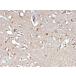 Immunohistochemistry - Anti-beta Amyloid Antibody [APP/3345] (A248989) - Antibodies.com