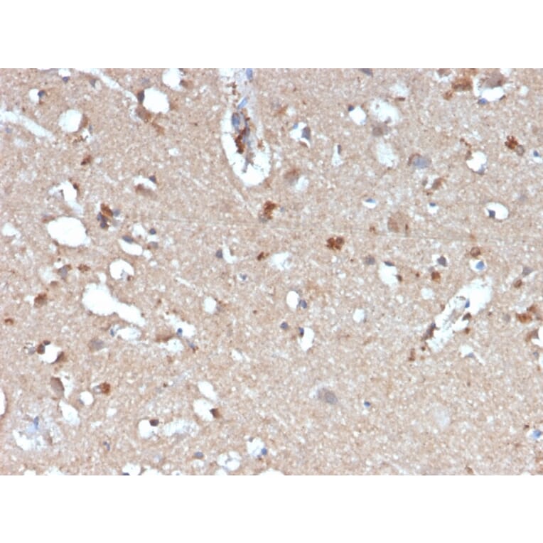 Immunohistochemistry - Anti-beta Amyloid Antibody [APP/3345] (A248989) - Antibodies.com