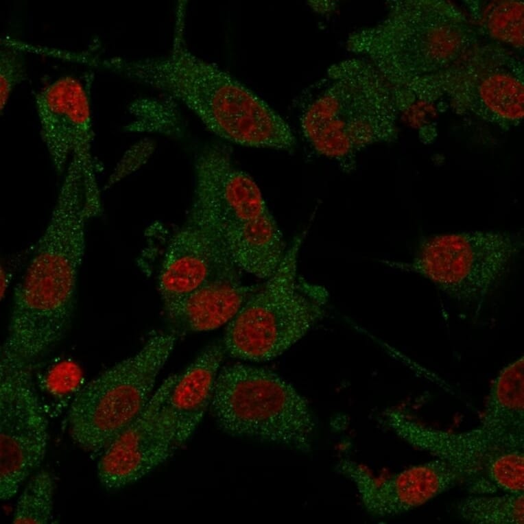 Immunofluorescence - Anti-beta Amyloid Antibody [APP/3345] (A248989) - Antibodies.com