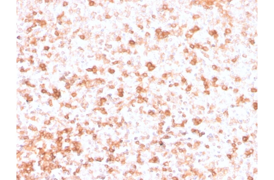 Immunohistochemistry - Anti-Lambda Light Chain Antibody [rLLC/3777] (A248989) - Antibodies.com