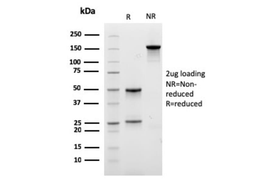 SDS-PAGE - Anti-Lambda Light Chain Antibody [rLLC/3777] (A248990) - Antibodies.com