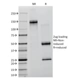 SDS-PAGE - Anti-Lambda Light Chain Antibody [ICO-106] (A248990) - Antibodies.com
