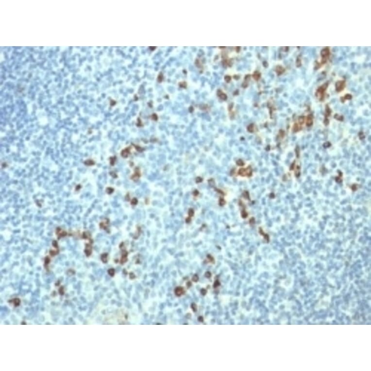 Immunohistochemistry - Anti-Lambda Light Chain Antibody [HP6054] (A248992) - Antibodies.com
