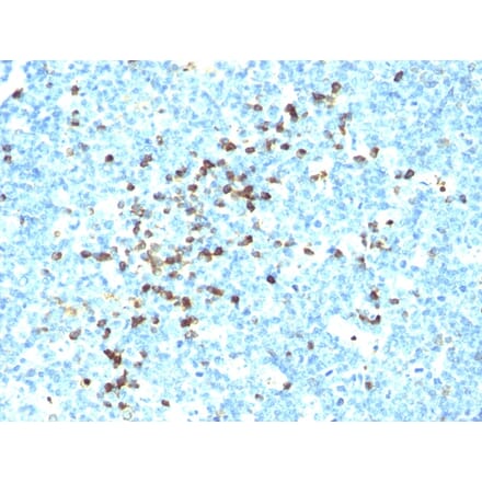 Immunohistochemistry - Anti-Lambda Light Chain Antibody [LcN-2] (A248993) - Antibodies.com