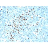 Immunohistochemistry - Anti-Lambda Light Chain Antibody [LcN-2] (A248993) - Antibodies.com