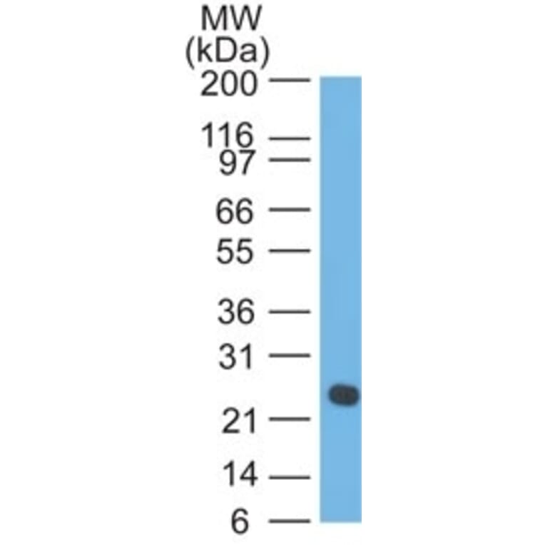 Western Blot - Anti-Lambda Light Chain Antibody [LcN-2] (A248993) - Antibodies.com