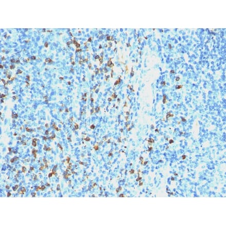 Immunohistochemistry - Anti-Lambda Light Chain Antibody [SPM559] (A248993) - Antibodies.com
