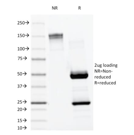 SDS-PAGE - Anti-Lambda Light Chain Antibody [LAM03] (A248994) - Antibodies.com