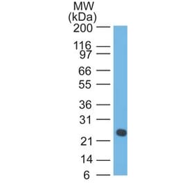 Western Blot - Anti-Lambda Light Chain Antibody [LcN-2 + ICO-106] (A248995) - Antibodies.com