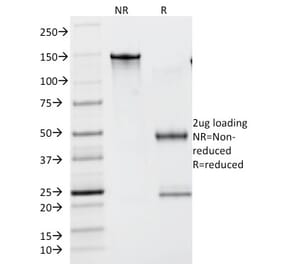SDS-PAGE - Anti-Lambda Light Chain Antibody [N10/2] (A248997) - Antibodies.com