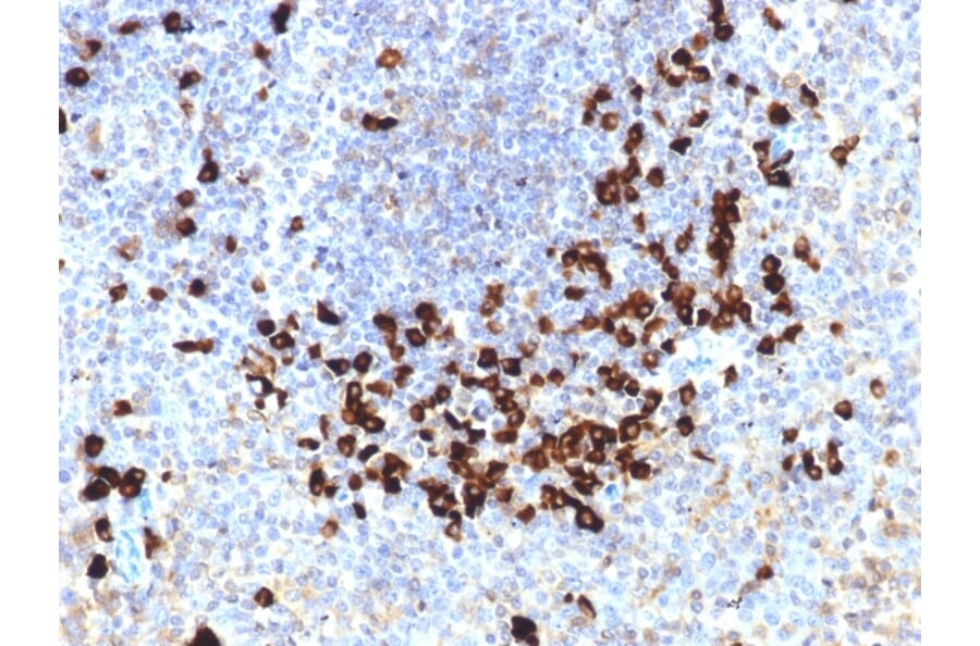 Immunohistochemistry - Anti-Lambda Light Chain Antibody [LLC/1738] (A248998) - Antibodies.com