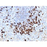 Immunohistochemistry - Anti-Lambda Light Chain Antibody [LLC/1738] (A248998) - Antibodies.com