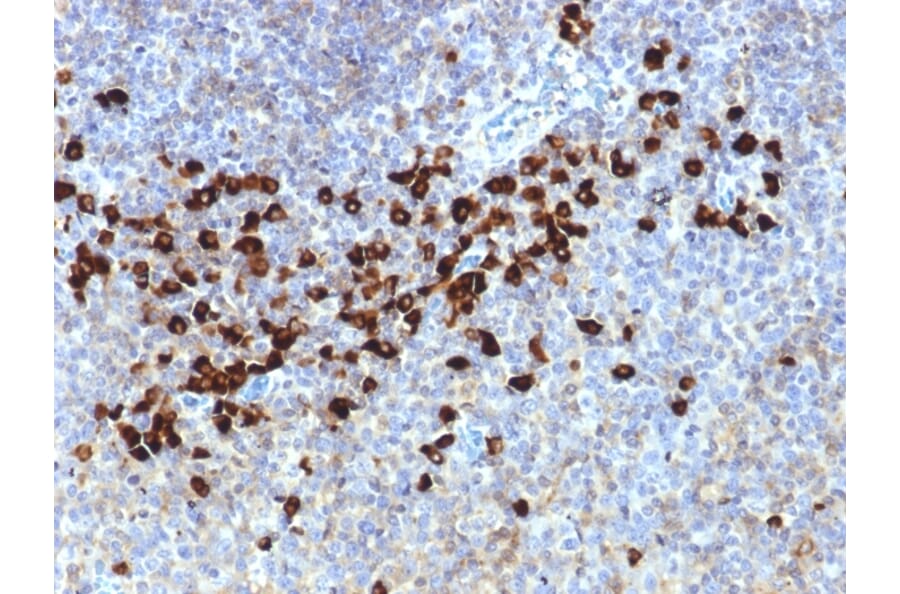 IHC - Anti-Lambda Light Chain Antibody [LLC/1738] (A248998)