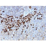 Immunohistochemistry - Anti-Lambda Light Chain Antibody [LLC/1738] (A248997) - Antibodies.com