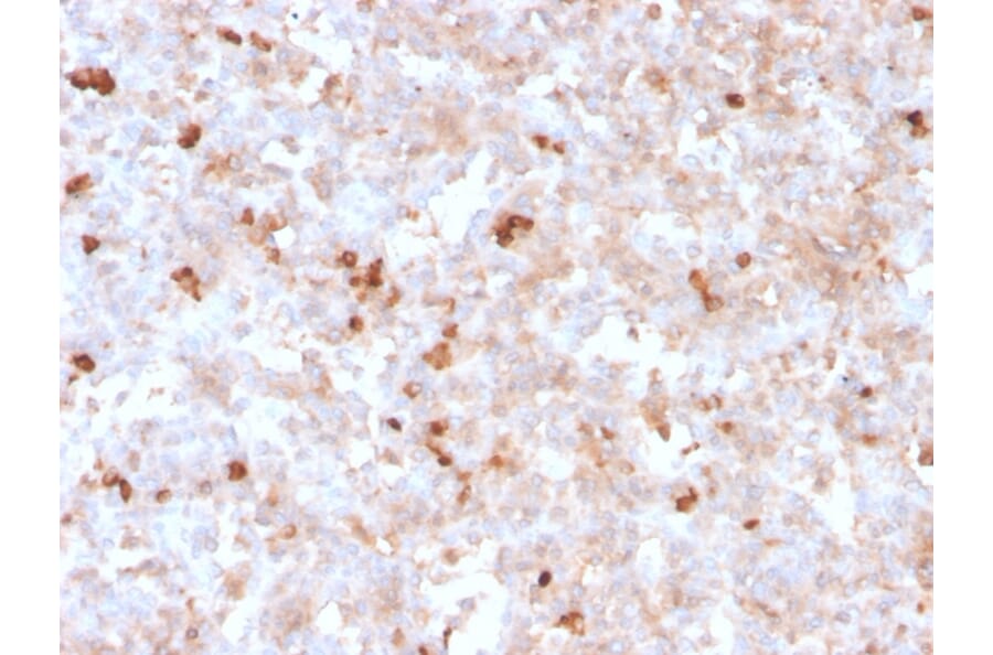 Immunohistochemistry - Anti-Lambda Light Chain Antibody [rLLC/1738] (A248999) - Antibodies.com