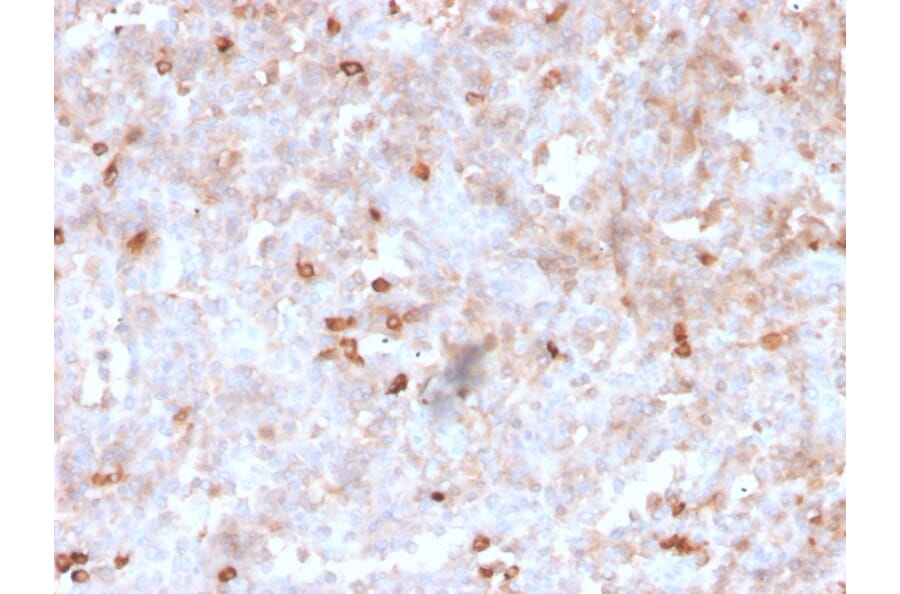 Immunohistochemistry - Anti-Lambda Light Chain Antibody [rLLC/1738] (A248998) - Antibodies.com