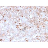 Immunohistochemistry - Anti-Lambda Light Chain Antibody [rLLC/1738] (A248998) - Antibodies.com