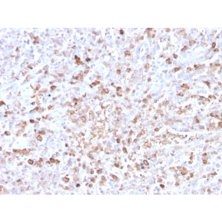 Immunohistochemistry - Anti-Lambda Light Chain Antibody [LLC/3778R] (A249000) - Antibodies.com