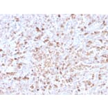 Immunohistochemistry - Anti-Lambda Light Chain Antibody [LLC/3778R] (A249000) - Antibodies.com