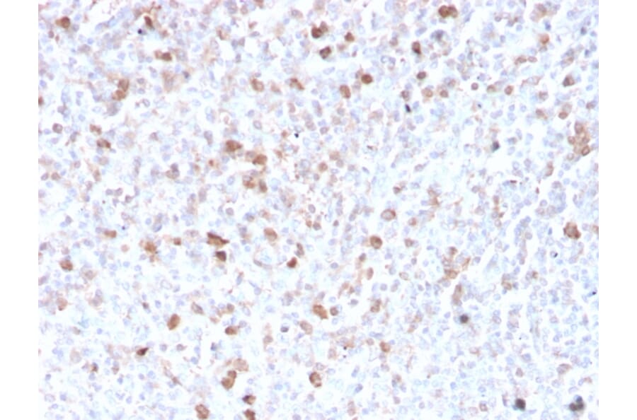 Immunohistochemistry - Anti-Lambda Light Chain Antibody [LLC/3778R] (A248999) - Antibodies.com