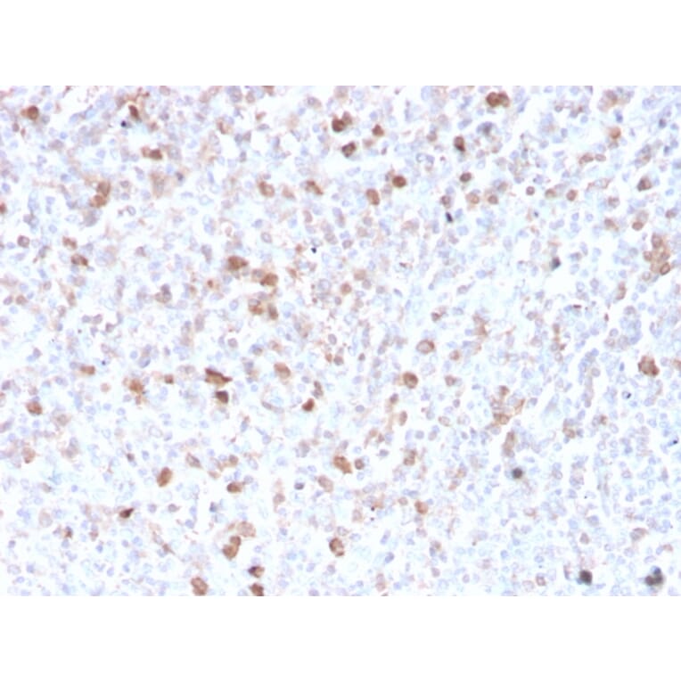 Immunohistochemistry - Anti-Lambda Light Chain Antibody [LLC/3778R] (A248999) - Antibodies.com
