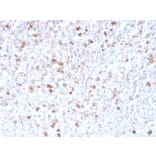 Immunohistochemistry - Anti-Lambda Light Chain Antibody [LLC/3778R] (A248999) - Antibodies.com