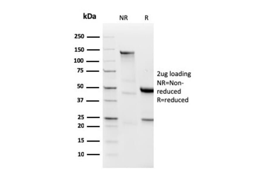 SDS-PAGE - Anti-Lambda Light Chain Antibody [LLC/3778R] (A249000) - Antibodies.com