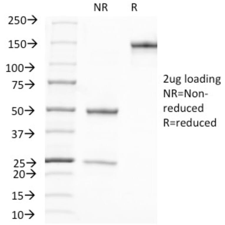 SDS-PAGE - Anti-Prostate Specific Antigen Antibody [A67-B/E3] (A249002) - Antibodies.com