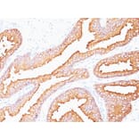 Immunohistochemistry - Anti-Prostate Specific Antigen Antibody [SPM352] (A249002) - Antibodies.com
