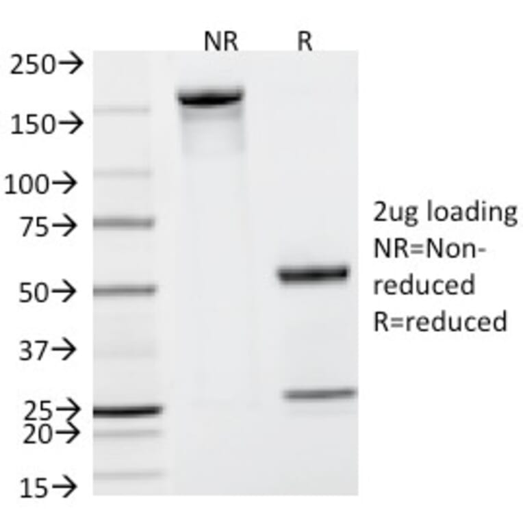 SDS-PAGE - Anti-Prostate Specific Antigen Antibody [KLK3/801] (A249004) - Antibodies.com