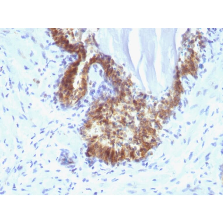Immunohistochemistry - Anti-Prostate Specific Antigen Antibody [KLK3/1248] (A249005) - Antibodies.com