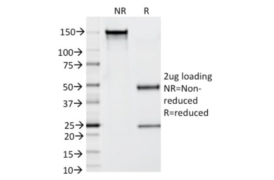 SDS-PAGE - Anti-Prostate Specific Antigen Antibody [KLK3/1248] (A249006) - Antibodies.com