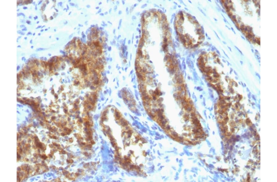 Immunohistochemistry - Anti-Prostate Specific Antigen Antibody [A67-B/E3 + 1A7] (A249006) - Antibodies.com