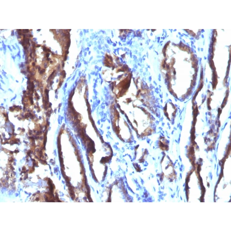 Immunohistochemistry - Anti-Prostate Specific Antigen Antibody [3E6] (A249008) - Antibodies.com