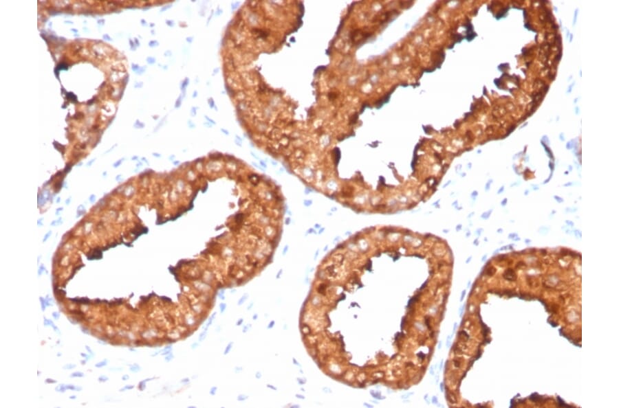 Immunohistochemistry - Anti-Prostate Specific Antigen Antibody [KLK3/4551R] (A249009) - Antibodies.com
