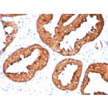 Immunohistochemistry - Anti-Prostate Specific Antigen Antibody [KLK3/4551R] (A249009) - Antibodies.com